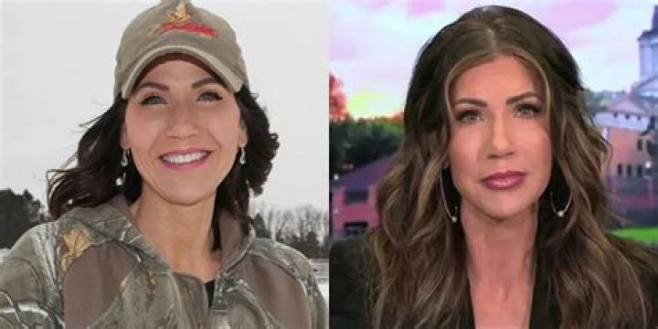 Kristy Noem's Plastic Surgery Revelations
