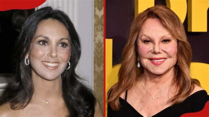 Marlo Thomas Plastic Surgery, Facelift, Nose Job, And BeforeAfter